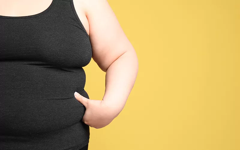 O que é a Cirurgia Bariátrica?