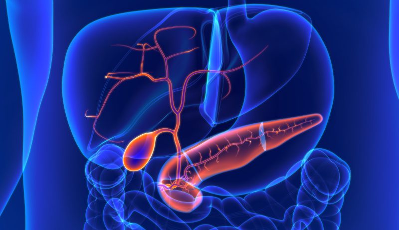 Colecistite, Colelitíase e Coledocolitíase: O que são e como tratar?